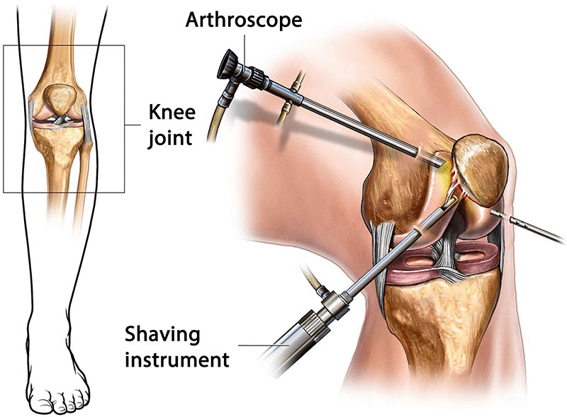 Arthroscopy and Sports Medicine